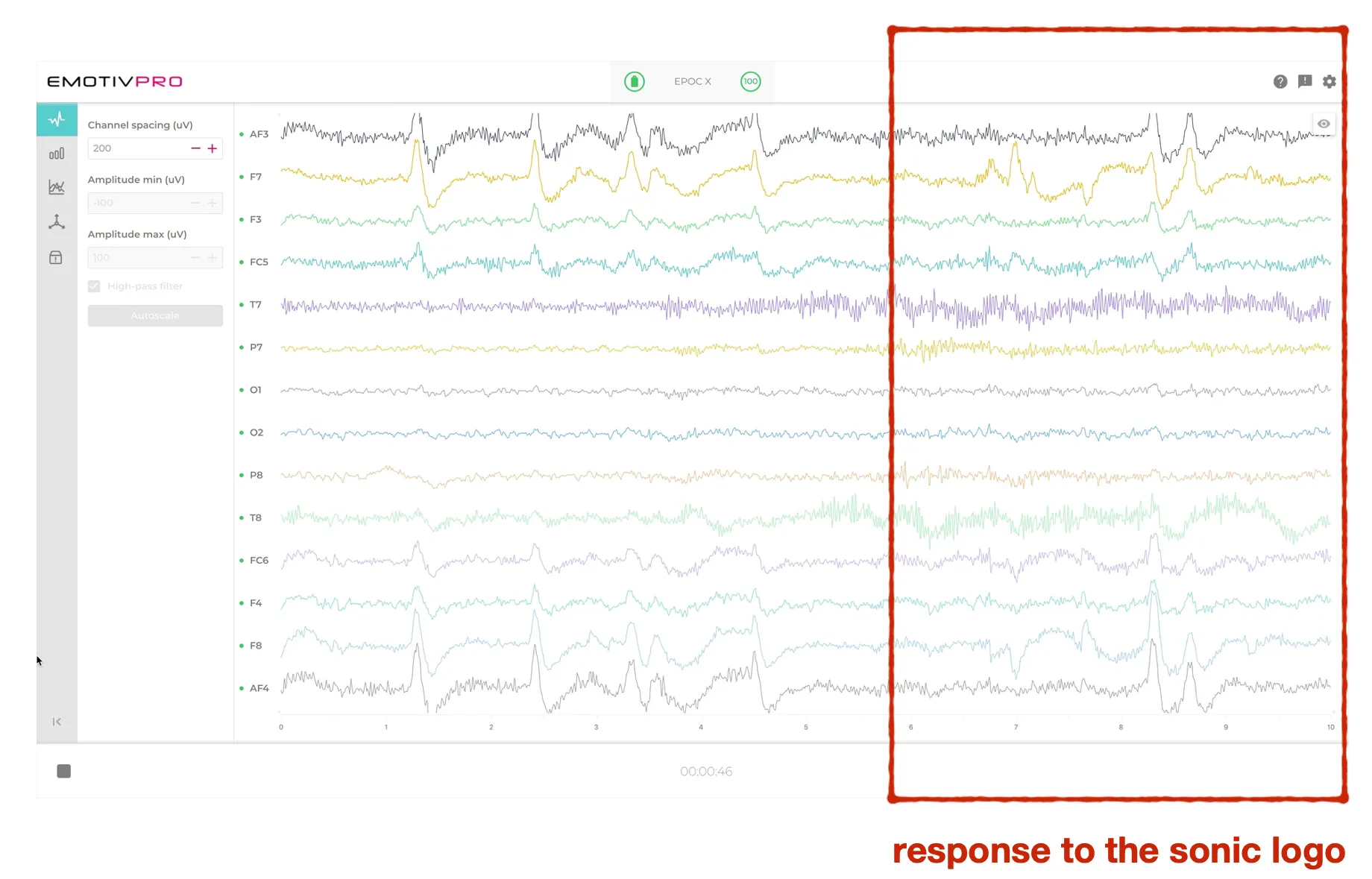 Brain wave activity while listening to environmental sounds and Kia’s sonic logo.