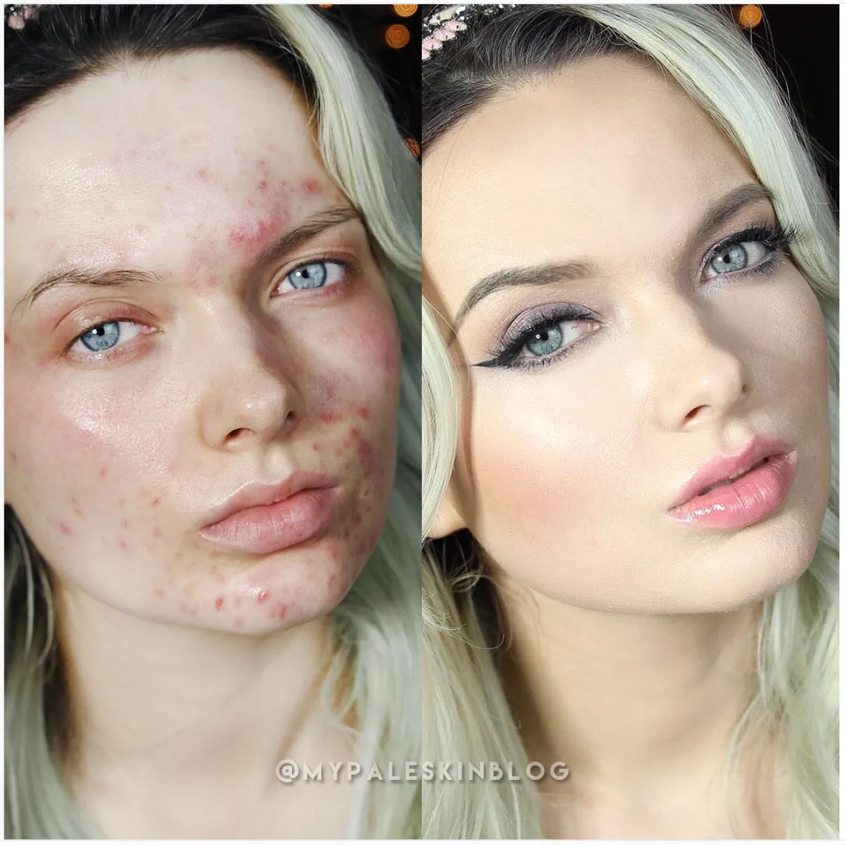 Before and after - Em Ford.