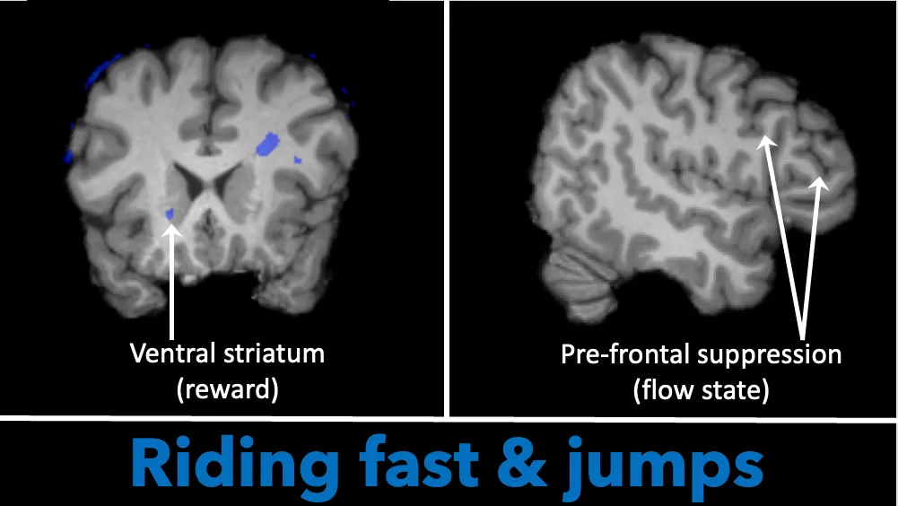 Activation in Olly’s brain for particularly exciting riding