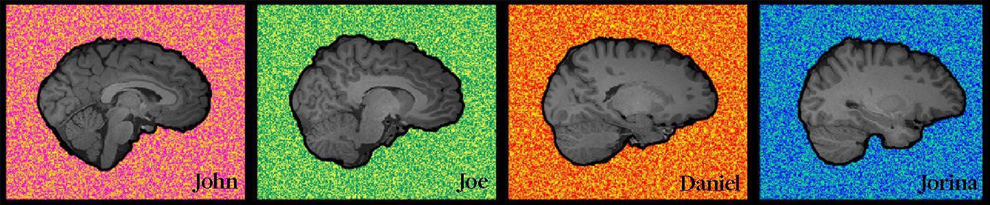 Four colourful labelled brain scans